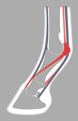 The ACR wider at the toe shoe avoids penetration and thus relieves the suspensory apparatus.