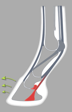 wider toe and reduced rear lever arms, the farrier can easily withdraw the shoe under the foot. This shoe is especially useful for podotrochlear syndromes
