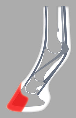 ACR 800 Heart Bar
