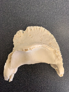 Chris Pollitt Foundered Hoof Capsule with Pathological Pedal Bone